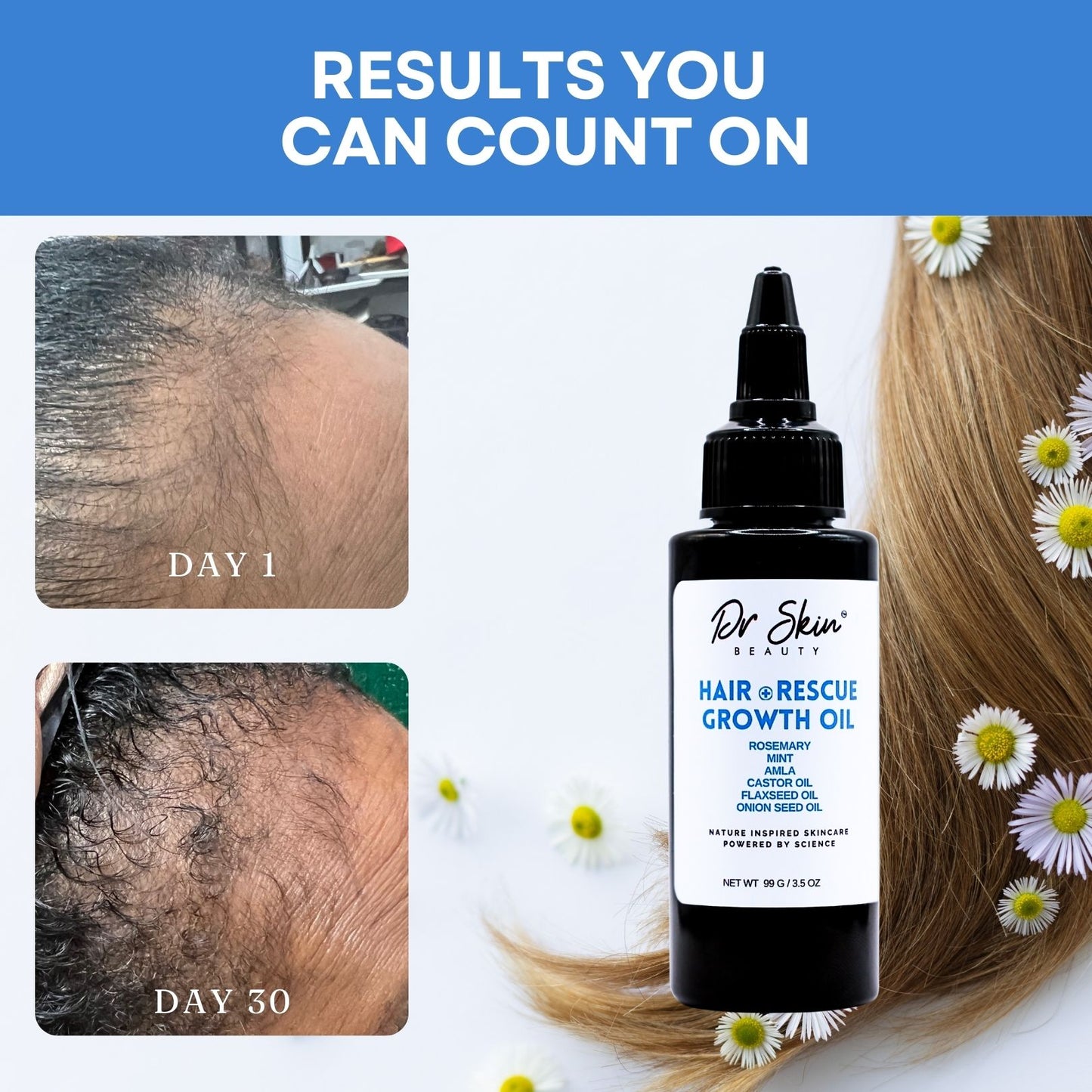 HAIR RESCUE GROWTH OIL 3.5oz | Stimulate Hair Growth, Strengthen Strands, and Restore Scalp Health